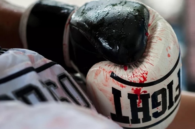 وفاة ملاكم اسكتلندي بعد المباراة