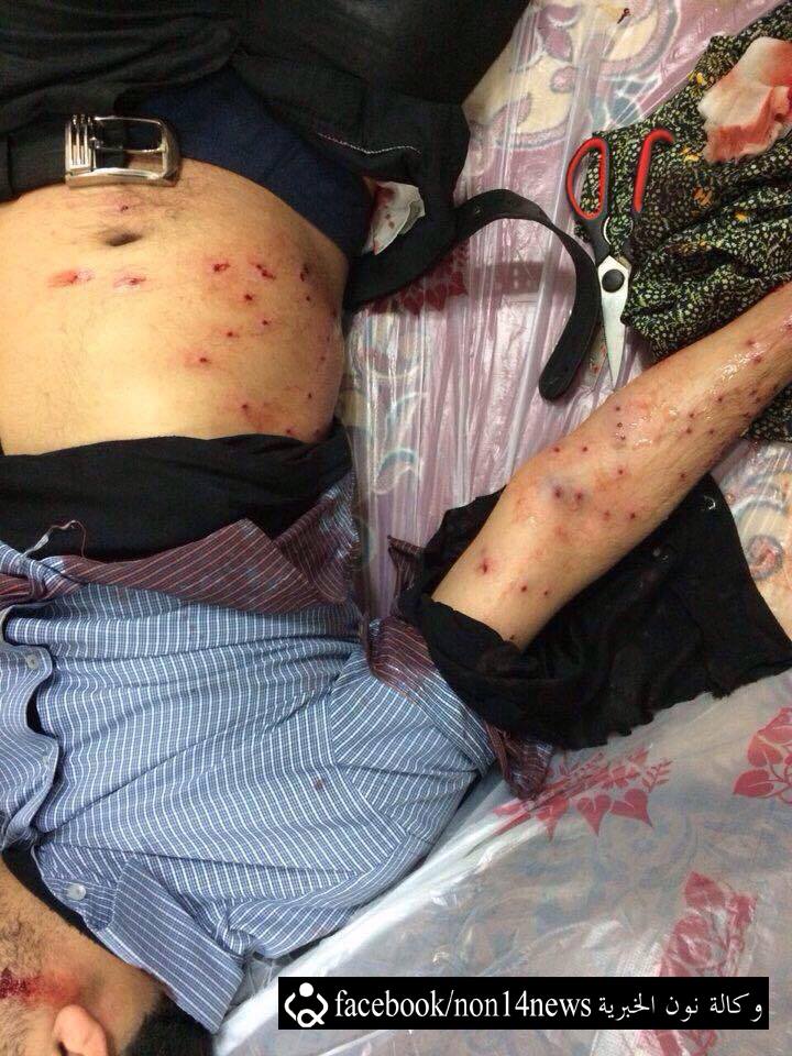 بالصور:متظاهرون بحرينيون يتعرضون للاعتداء بسبب تظاهرات سلمية للمطالبة بالافراج عن الشيخ السلمان