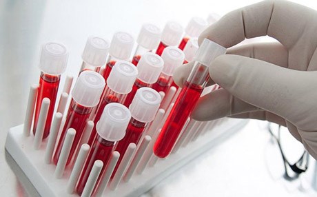 العالم ينفق نحو 110 مليار دولار سنوياً لمعالجة السرطان