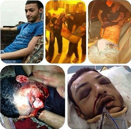 بالصور :تشييع شاب قتل دهسا في البحرين وشعارات ترافق التشيع تطالب باسقاط النظام الحاكم