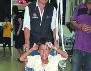 سمكة حية داخل رئة طفل هندي