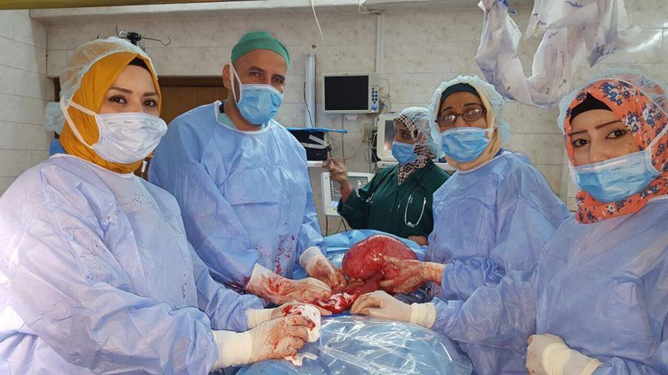 بالصور:عملية جراحية مُعقدة في كربلاء تنهي معاناة فتاة ثلاثينية بـ " رحمين "