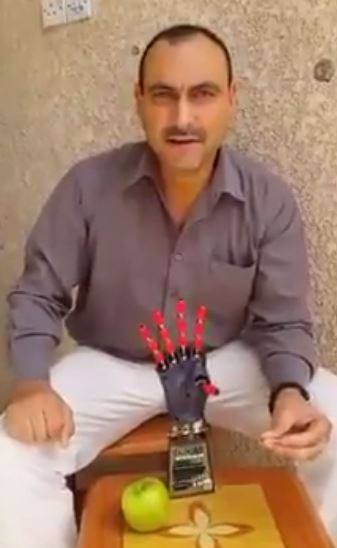 بالفيديو: استاذ من المعهد التقني بعقوبة يتمكن من اختراع ذراع الكترونية تعمل عمل الذراع البشرية.