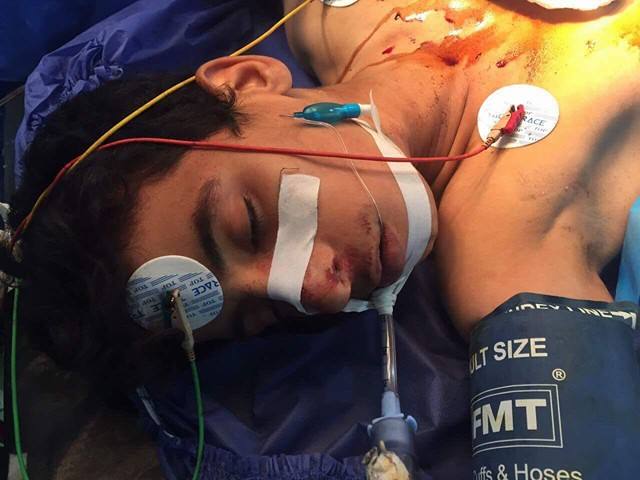 كربلاء :طبيب جراح ينقذ حياة شاب تعرض للطعن بسكين إخترقت صدره وإستقرت داخل القلب(مصور)