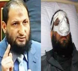 حزب سلفي مصري يفصل أحد نوابه لإجرائه عملية تجميلية للأنف