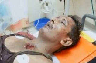 البحرين.. مقتل شخصين وإصابة آخر في سلسلة تفجيرات بالعاصمة المنامة