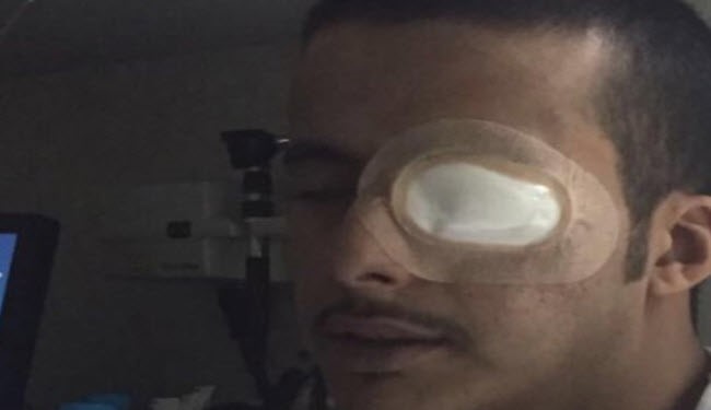 بالصورة.. حركة انصارالله يفقأون عين امير سعودي