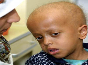 العراق يسجل 16 الف اصابة سنوية بالسرطان