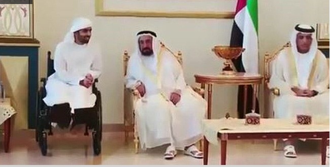 بالصور:ابن حاكم رأس الخيمة مقطوع الرجلين لاصابته بالعدوان على اليمن