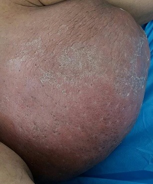 كربلاء: رفع كتلة غريبة وزنها (10) كغم من على فخذ مريض في مستشفى الإمام زين العابدين عليه السلام (مصور)