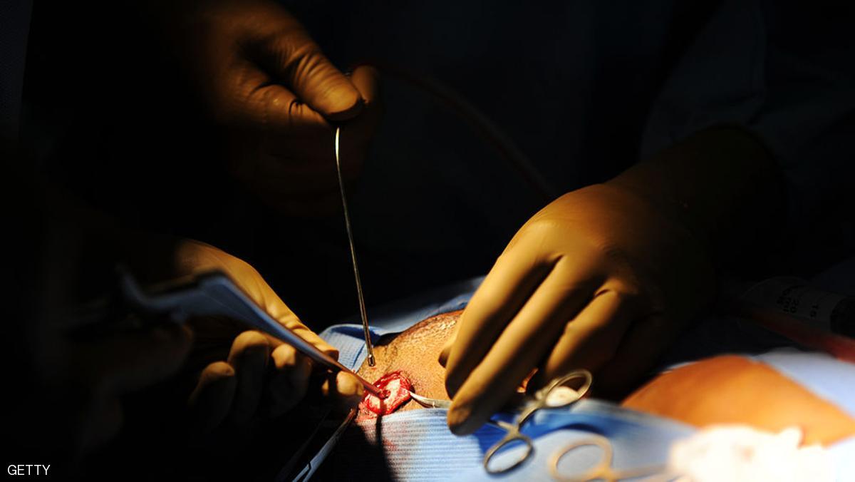 كيميرا.. بكتيريا مقلقة لمرضى خضعوا لجراحة القلب