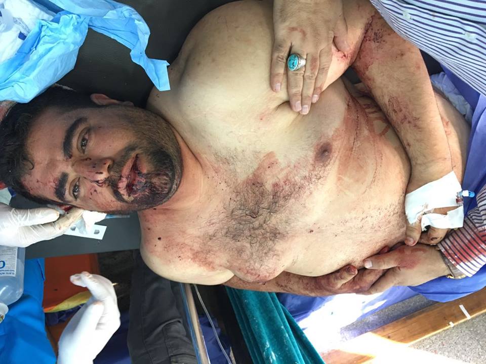 اصابة ابناء عارف نصر الله مدير علاقات مكتب  الشيرازي في تفجير كربلاء