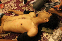 استشهاد فتى بحريني بسلاح الشوزن المحرم دوليا غربي المنامة +صورة