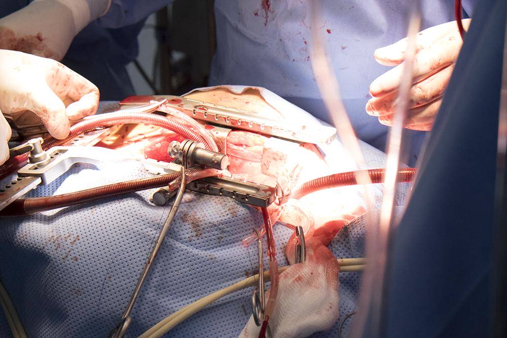 بالصور:لأوّل مرّة في كربلاء إجراءُ عمليّة القلب المفتوح بمستشفى الكفيل