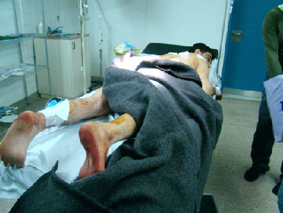 العرعوريون يستهدفون زوار الامام الحسين بصواريخ (مصور)