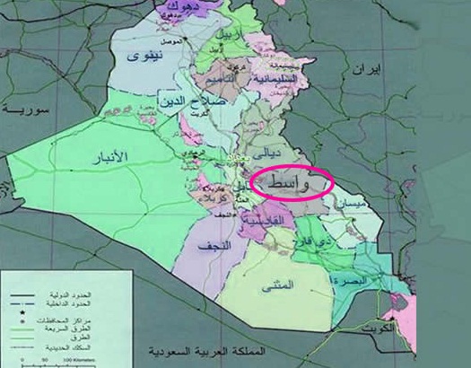 اطول زائده دودية بالتاريخ تم استئصالها من مريض في محافظة واسط