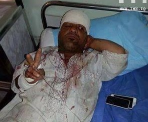 بالصورة :اصابة الفنان الكوميدي سعدون الجبوري (عبوري) اثناء قتاله الدواعش في الضلوعية