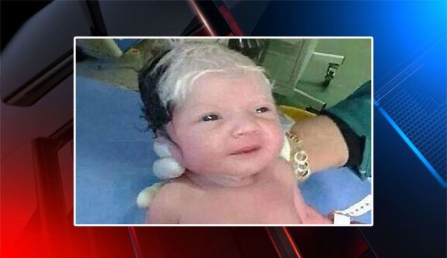 ولادة طفل بشعر أشيب.. تثير ضجة كبيرة