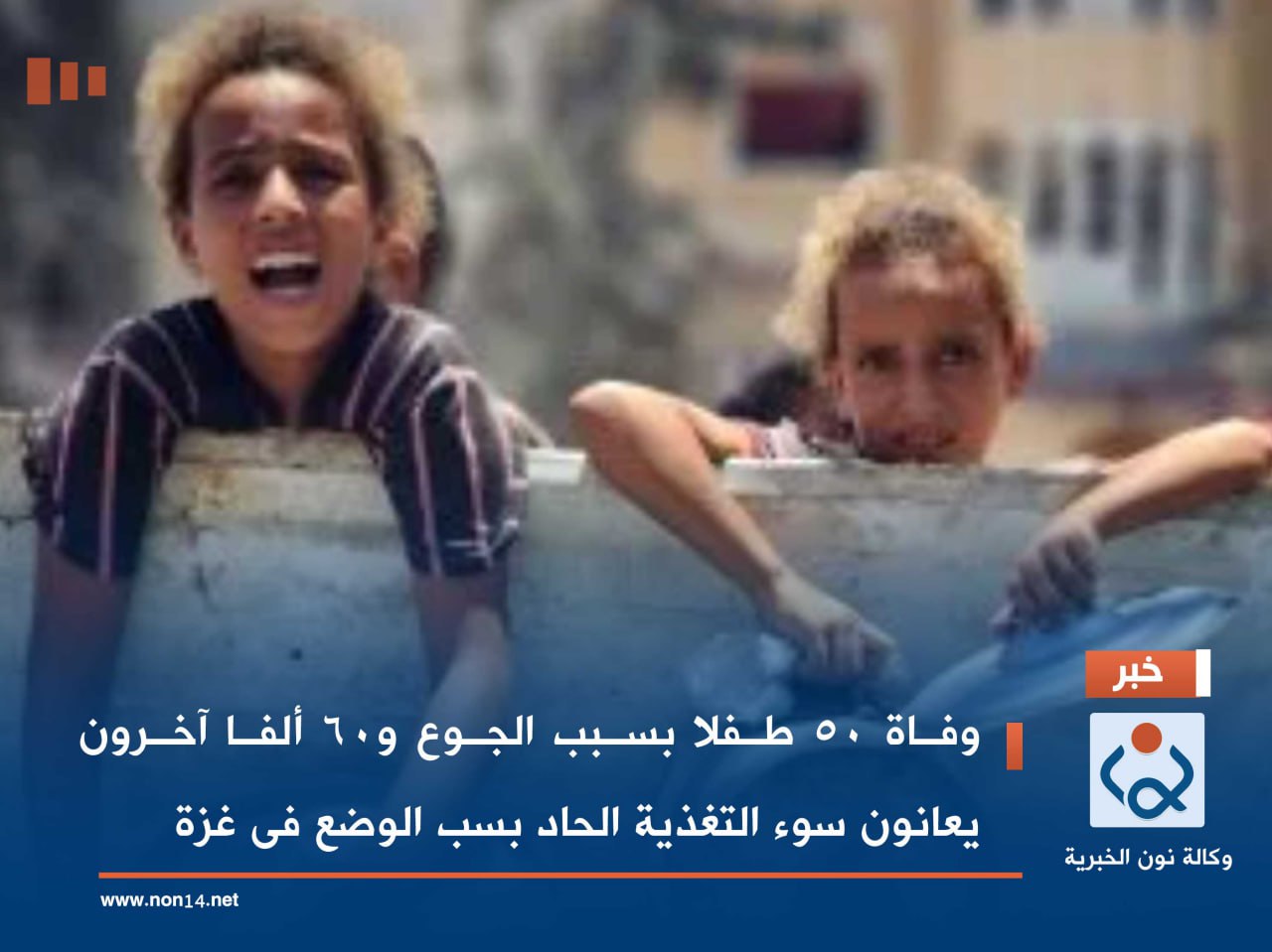 وفاة 50 طفلا بسبب الجوع و60 ألفا آخرون يعانون سوء التغذية الحاد بسب الوضع فى غزة