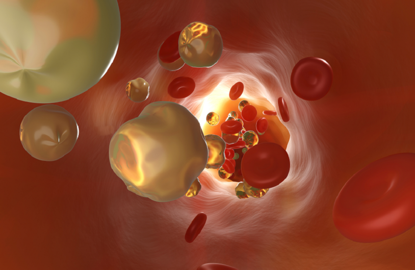 نصائح غذائية لخفض الكوليسترول في غضون 10 أيام