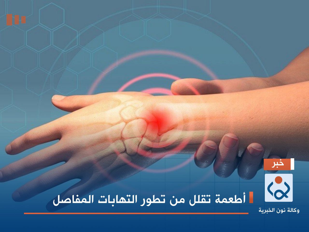 أطعمة تقلل من تطور التهابات المفاصل