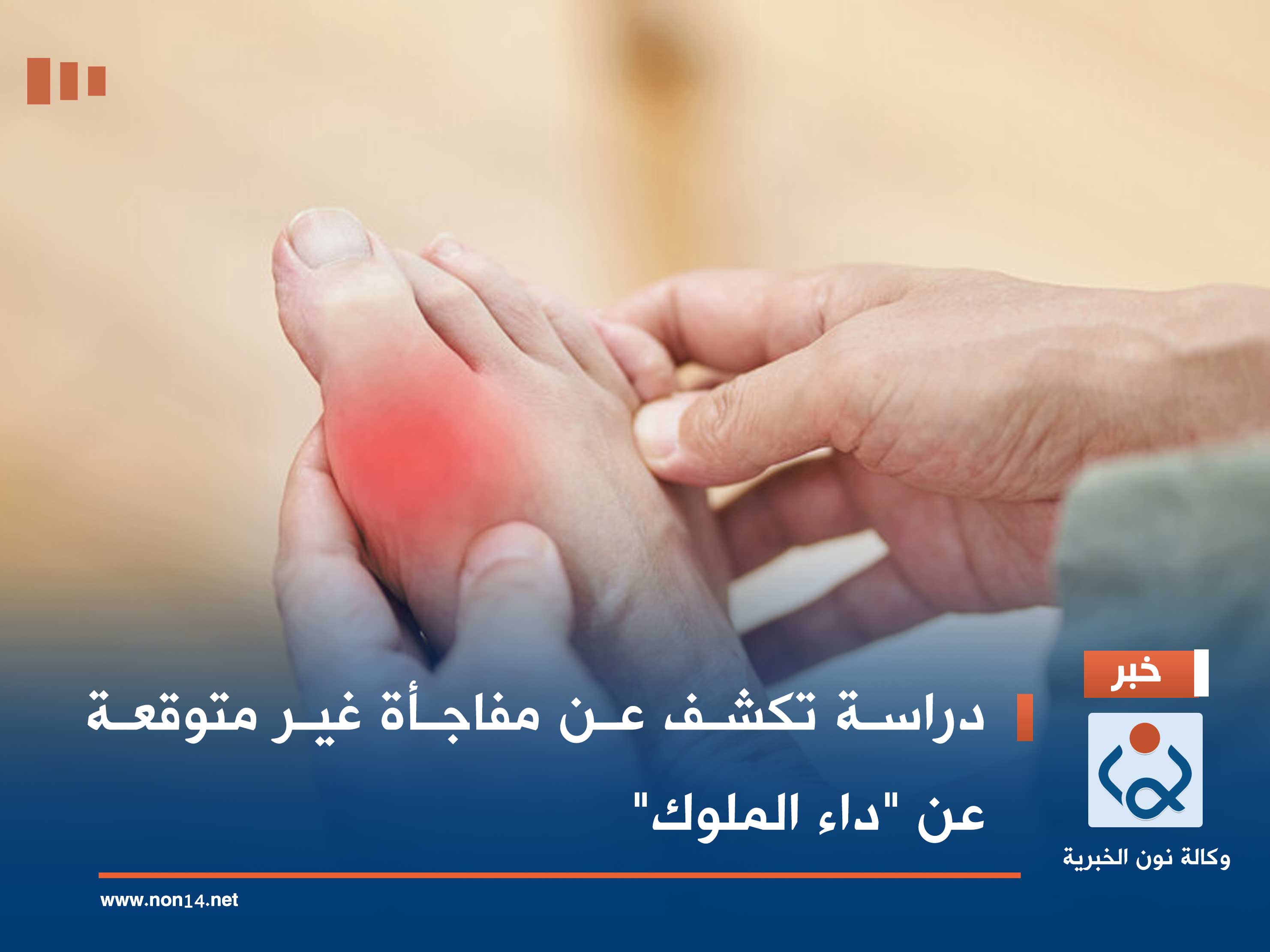 دراسة تكشف عن مفاجأة غير متوقعة عن "داء الملوك"