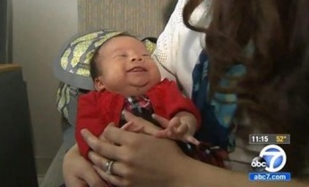 ولادة طفلة بلا دم !