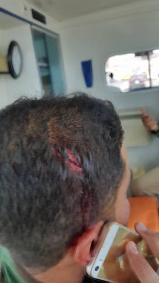 شاهد بالصور جرحى اعتداء  طلبة كرد على زملائهم من العرب والتركمان بسبب رفع راية لبيك ياحسين ولبس زي الحشد الشعبي