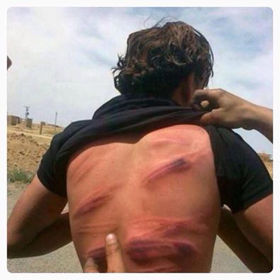 ًبالصورة :داعش تجلد مواطن عراقي في الانبار لانه يدخن