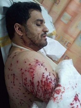 اصابة نائب بلدي في البحرين على يد قوات النظام البحريني