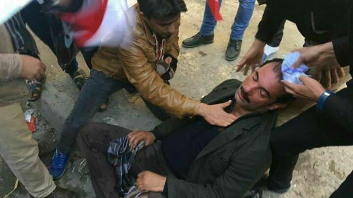 بالصورة: اصابة الفنان سنان العزاوي بتظاهرات ساحة التحرير