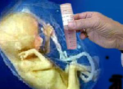 افتتاح اول مركز متخصص بمعالجة العقم بتقنية اطفال الانابيب بالموصل