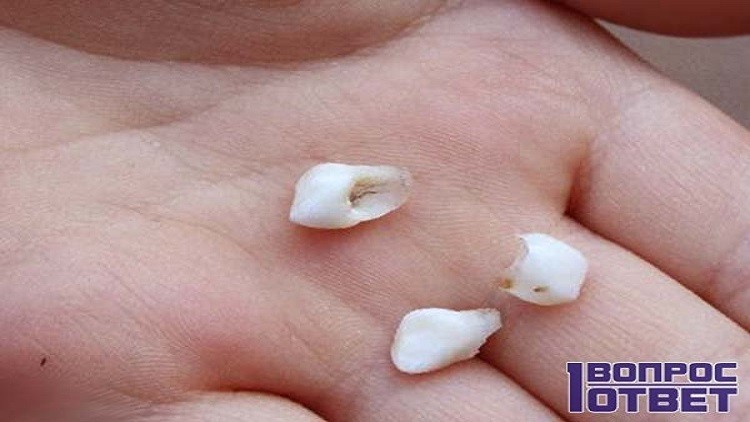 العلماء: يفضل الاحتفاظ بأسنان الأطفال اللبنية بعد سقوطها