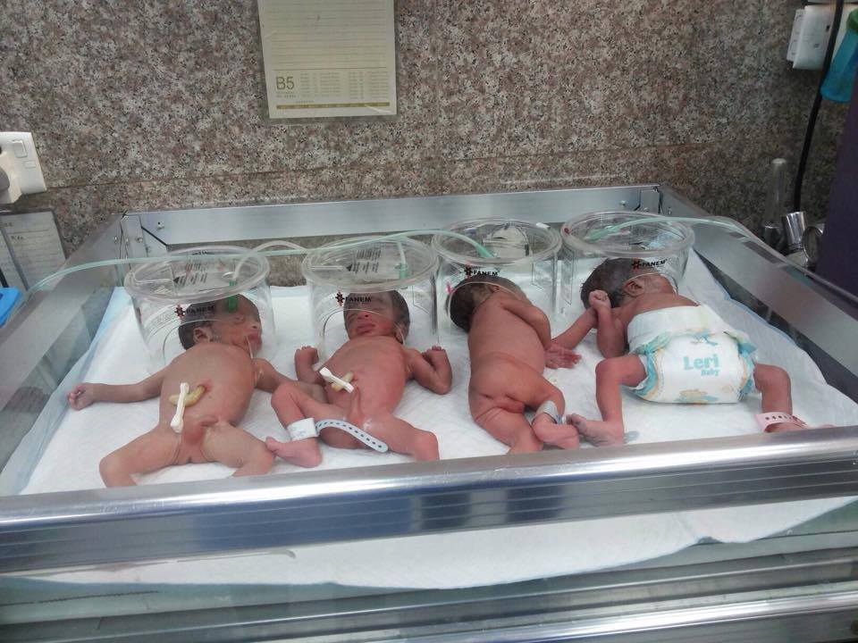 سيدة كربلائية تلد توأماً رُباعياً في حالة نادرة