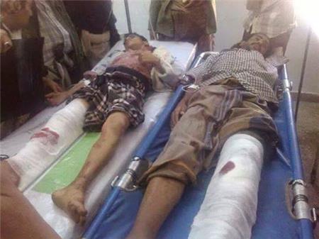 مستشفى الحسين في كربلاء يستقبل بحدود 100 حالة اصابة بسبب الدراجات النارية و25% منها يودي الى الوفاة