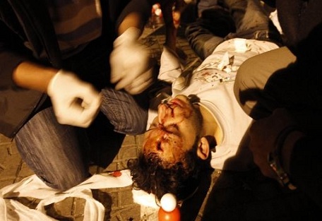 ثورة عارمة تجتاح الشارع المصري وأكثر من مئة مصاب لغاية الان