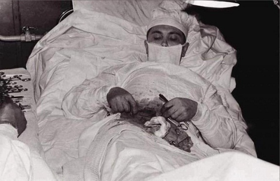 صورة نادرة لجراح وهو يستأصل زائدته الدودية بنفسه بعملية جراحية