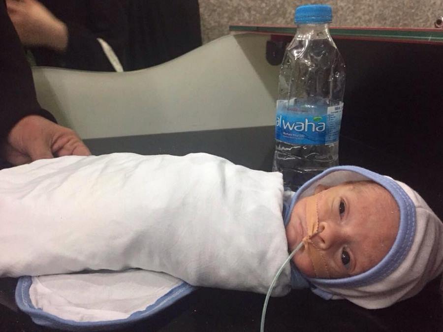 كربلاء: انقاذ حياة طفل خديج عمرهُ الجنيني (6) أشهر +صورة