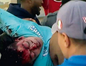 مجزرة في بنغازي والقذافي يستعين بمرتزقة أفارقة