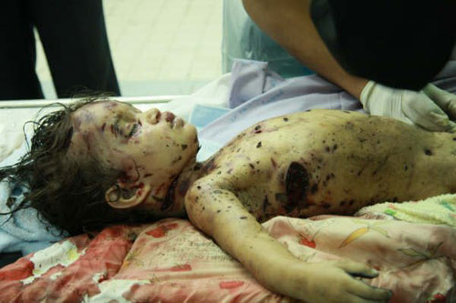 مقتل طفلة بحرينية باسحلة محظورة دوليا تستخدمها القوات الحكومية ضد المتظاهرين