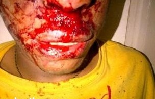 اعتداء وحشي على صبي بالبحرين +صورة