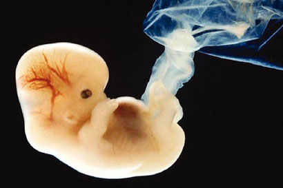 الإجهاض (إرهاب يبدأ قبل الولادة) وعلماء الدين يحرّموه بعد نفخ الروح ويختلفوا على ما قبل ذلك