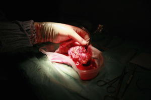 قضية رأي عام ..شاب يبيع كليته بعد ان اوصد المسؤولون باب التعيين في وجهه !!