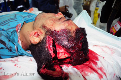 صور حصرية لموقع نون تحتوي على مشاهد مؤلمة لمجازر بحق الشعب البحريني الاعزل