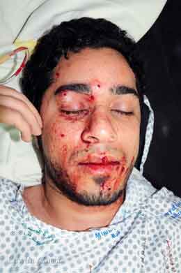 صور جديدة وحصرية لموقع نون من داخل مستشفى السلماني بالبحرين