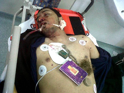 صور حصرية لموقع نون من الداخل البحريني لعمليات الدهم والاحتجاجات والاعتقالات للمصابين والاطباء