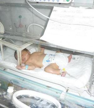 ولادة نادرة لطفل في كربلاء له قلب في الجهة اليمنى وضمور في الشريان الابهر