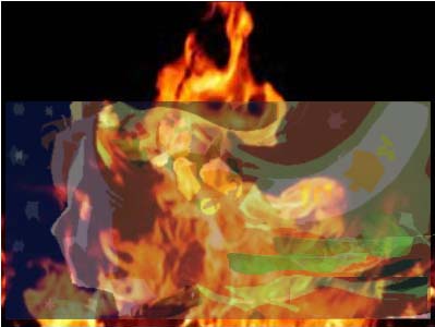 مصدر طبي لموقع نون ازدياد حالات الانتحار حرقا  بين الامهات الصغيرات واقسام الحروق تستقبل الكثير من تلك الحالات