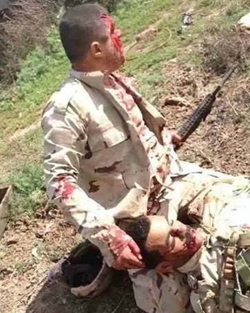 شاهدوا صورة جندي عراقي في احدى معارك الانبار وهو جريح ولم يترك زميله الشهيد في ارض المعركة