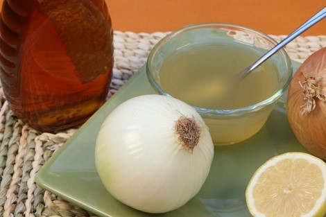 وداعا لتساقط الشعر مع "عصير البصل".. إليك الخلطة